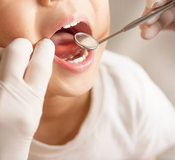 Pedodonzia | Cure Dentarie per Bambini
